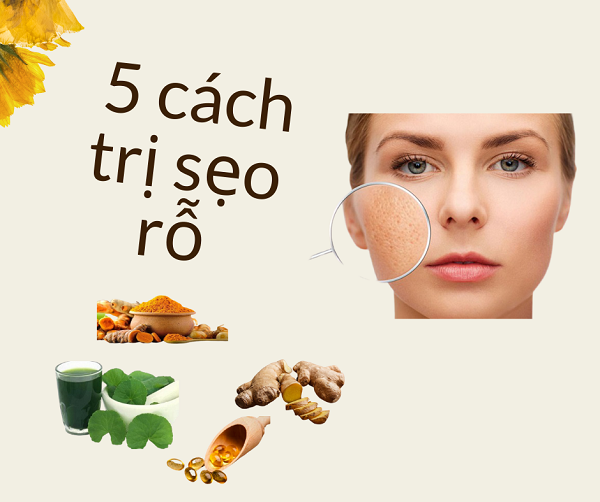 bo-tui-5-cach-tri-seo-ro-lau-nam-tu-nguyen-lieu-tu-nhien-nhanh-nhat-va-hieu-qua-tai-nha7.png