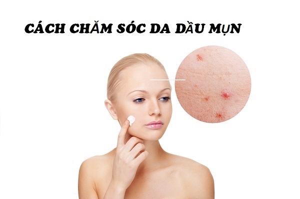 Cách chăm sóc da nhờn mụn