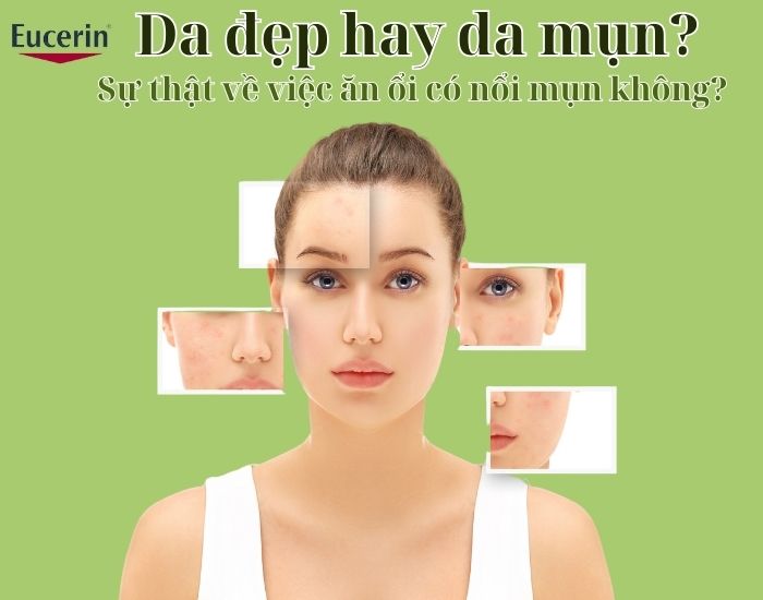 Da đẹp hay da mụn? Sự thật về việc ăn ổi có nổi mụn không?
