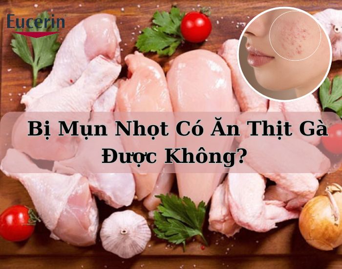 Bị mụn nhọt có ăn thịt gà được không?