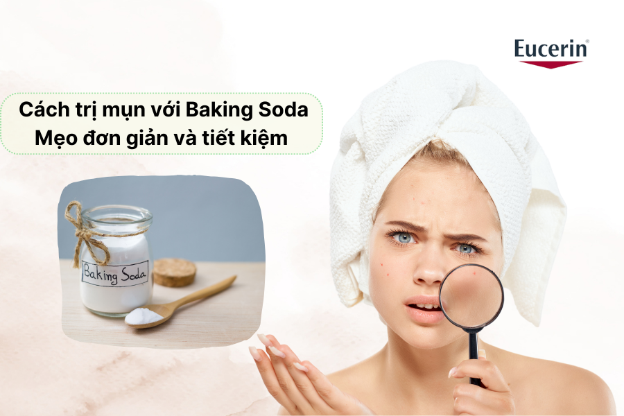 Cách trị mụn với baking soda