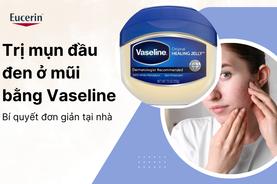 Trị mụn đầu đen ở mũi bằng Vaseline - Bí quyết đơn giản tại nhà