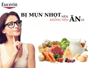 bi20mun20nhot20kieng20an20gi