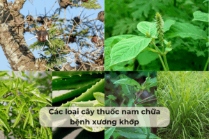 cac loai cay thuoc nam chua benh xuong khop