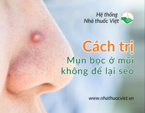cach tri mun boc o mui tai nha khong de lai seo