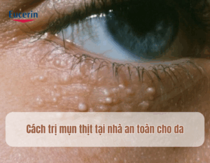 cach20tri20mun20thit20tai20nha20an20toan20cho20da