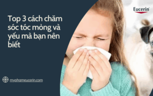 cachchamsoc