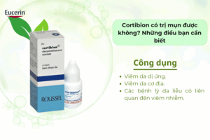cortibion co tri mun duoc khong nhung 20dieu ba can biet