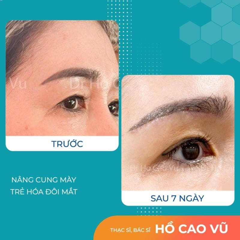 ket-qua-truoc-va-sau-khi-nang-cung-may-cua-co-khach-trung-nien.jpg