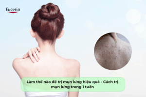 lam the na0 de tri mun lung hieu qua cach tri mun20lung trong 1 tuan