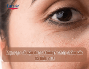 mun20gao20co20nang20duoc20khong20cach20cham20soc20da20hieu20qua