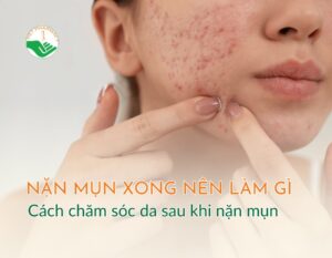 nan mun xong nen lam gi