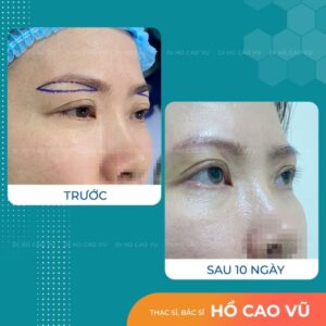 nang cung may la dich vu lam dep duoc dong dao phu nu trung nien tin dung