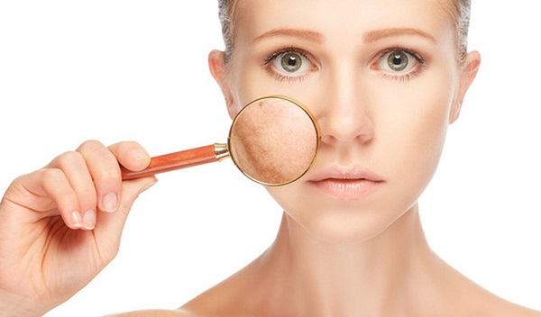 Không tẩy tế bào chết sẽ gây ra rất nhiều vấn đề cho da