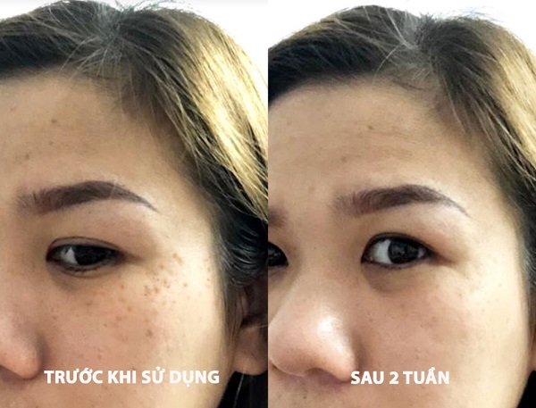 Tinh-chat-tri-tham-nam-eucerin-ultra-white-spotless-sopt-corrector.jpg