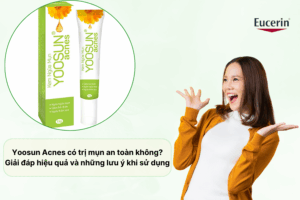 yoosun acnes co tri mun an toan khong giai dap hieu qua va nhung luu y khi su dung